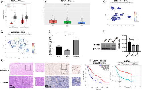 Figure 2. The low expression of GRM4 in glioma is associated with prognosis. (A) According to the GEPIA database, the mRNA expression level of GRM4 in glioma tissues exhibited a statistically significant decrease compared to normal tissues. (B) Based on the data obtained from the CGGA database, the mRNA expression of GRM4 was found to be reduced in high-grade gliomas (C-D)GRM4 mRNA expression based on CancerSEA database GSE84465 and GSE57872 datasets. T-SNE is utilized to depict the cellular distribution, where each point corresponds to a distinct cell. The color of each point signifies the expression level of GRM4 within the respective cell. (E-F) expression of the GRM4 in the pertinent groups was evaluated through the utilization of qPCR and Western blot. All the data are shown as the mean ± SD (three independent experiments). Sig: ns p ≥ 0.05, * p < 0.05, ** p < 0.01, *** p < 0.001, **** p < 0.0001. (G) HE staining and IHC representative images of glioma and adjacent tissues. (H) Overall survival Kaplan-Meier analysis revealed that glioma patients with low GRM4 mRNA expression had a shorter OS than patients with high GRM4 levels.