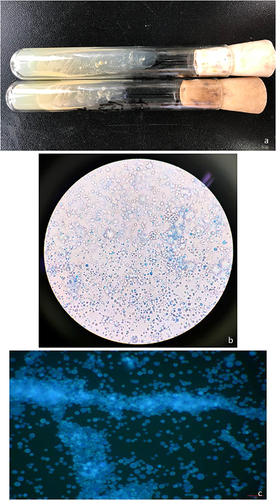 Figure 3 Colony Growth and Characteristics of Prototheca wickerhamii under Microscopy. (a) Smooth, creamy, white, and yeast-like colonies observed on SDA culture after 48 hours of incubation at 30°C. The characteristic endospore-containing sporangium of Prototheca wickerhamii. (b) Wet preparations stained with lactophenol cotton blue and (c) fluorochrome revealing the distinction from yeast due to the absence of budding.