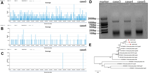 Figure 2 Sequencing results and evolutionary tree for case 3, 4, 5. (A) Genome coverage of Case: Mapping of the 864 mNGS reads from Chlamydia psittaci to reference genome. (B) Case: Mapping of the 102 reads. (C) Case 5: Mapping of the 2 reads. (D) Electrophoresis of ompA gene. PCR product sequencing showed that sequences ~1000 bp in size were obtained from all 3 samples. These 3 bands correspond to the expected fragment size. (E) Phylogenetic tree of ompA gene. Coverage: the percentage of the genome covered by reads over 1×. Average depth: average sequencing depth. The number of bases aligned to the reference genome divided by the length of the genome.