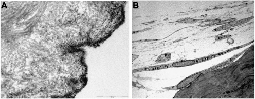 Figure 6 Electron transmission microscopy showing preserved the architectural structure of the dermis, integrity of the basal membrane and skin polarization (A). Histocompatibility test with human fibroblasts, colonizing the dermal surface (B).