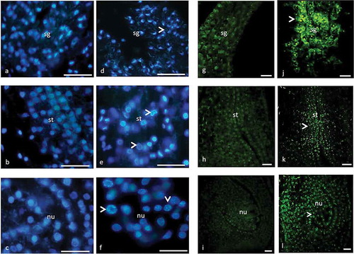 Figure 1. Stigma (a, d, g, j), style (b, e, h, k) and nucellar tissue (c, f, i, l) of female flower with DAPI (a–f) and TUNEL (g–l) assay. (a–c) Prior to PCD, chromatin is evenly distributed in the nuclei. (g–i) Prior to PCD, TUNEL is negative. (d–f) Condensed chromatin (arrow) in nuclei in advanced stage of PCD. (j–l) TUNEL is positive (arrow) in advanced stage of PCD. sg, stigma; st, style; nu, nucellus. Scale 10 µm (a–f) and 50 µm (g–l).