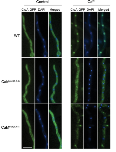 Figure 5. Localization of CrzA-GFP in three indicated strains (WT、CaMmut(1,2,4)、CaMmut(1,3,4)). Strains were grown in minimal media (MM) for 10 h and observed by fluorescence microscopy with or without stimulation of 100 mM CaCl2. The nuclear localization of cells was visualized by DAPI staining. Bar, 10 μm.