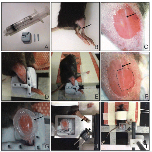 Figure 2. Tibialis anterior skeletal muscle preparation for multiphoton intravital imaging. (A) Materials prepared: a block of blu-tack with the limb indents (dotted lines), 2 strips of blu-tack for securing the limb, and a 10 ml syringe filled with vacuum grease. (B) Right tibia and thigh are cleanly shaved with a razor. Arrow and dotted line indicate the lateral saphenous vein that runs from the ankle to the tibialis posterior muscle. (C) A small window in the skin is made to reveal the muscle tissue. Notice that the right side of the tissue from the major connective tissue (visible as a vertical white line; arrow) has a lower density of blood vessels compared to the left side. (D) Mouse leg is secured with the 2 strips of blu-tack, one placed perpendicular to the other, over the ankle. Forceps were used to press down the blu-tack strips to the block. (E) View of whole animal with the right leg placed in the mold for imaging, and the left leg taped on the heating pad. (F) A small window (dotted line) is made in the outer connective tissue to reveal the skeletal muscle tissue for imaging. The window is made to the right of the major connective tissue (visible as a vertical white line; arrow). (G) A ring of vacuum grease is drawn around the imaging area (arrow). (H) The ring of vacuum grease is filled with a drop of PBS and a coverslip mounted on the coverslip holder is lowered over the tissue. The curved holder for the thermistor (top arrowhead) and the heater block (bottom arrowhead) are screwed on to the coverslip holder. (I) Overview of the final setup for the tibialis anterior skeletal muscle imaging.
