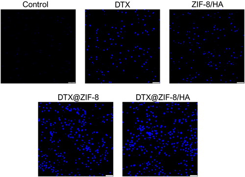 Figure 8. DAPI staining shows the induction of nuclear damage in the K562 cells after being treated with the IC50 concentration of DTX, ZIF-8/HA, DTX@ZIF-8, and DTX@ZIF-8/HA. Scale bar 100 µm.