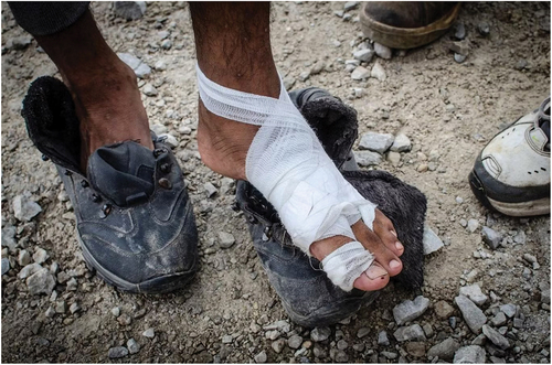 Figure 1. A man with a foot injury incurred during a pushback from the EU. He was beaten by Croatian police and his shoelaces were confiscated. (Photo: Thom Davies).