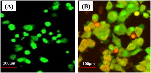Figure 6. In vitro cytotoxic evaluation of L929 cells treated with biosynthesized ZnONPs by Acridine orange and Ethidium bromide staining (A) Control (B) Cells treated with ZnONPs.