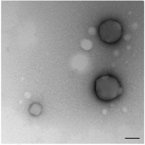 Figure 1. PHBV representative image of PHBV nanoparticles by transmission electron microscopy (TEM). Objective ×49,000 magnification. Bar size 100 nm.