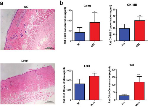 Figure 1. Effects of burn injury on the expression of C5b9, LDH, TnI, and CK-MB in rat myocardial tissues. (a). III burn rat model was validated by H&E staining of skin. (b). The expression levels of C5b9, LDH, TnI, and CK-MB in the burn injury group were significantly upregulated.*p-value < 0.05, **p-value < 0.01