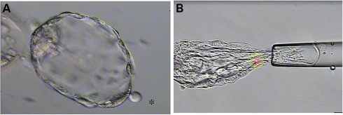 Figure 1 Laser manipulation of human embryos.