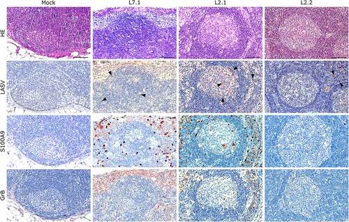 Figure 6. Comparative histopathology of a mesenteric lymph node after challenge with L7 or L2 LASV strains. HE: hematoxylin-eosin coloration. LASV: immunostaining of LASV glycoprotein-2c. Black arrowheads show infected cells in the mantle, the germinal center and the cortical sinus. S100A9: immunostaining of neutrophils. GrB: immunostaining of cytotoxic cells. Scale bar: 100 µm.
