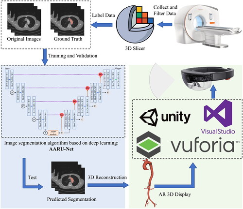 Figure 1. The overall framework of the proposed AR navigation method. The complete experimental process mainly includes: Collect and filter data; label data by using 3D Slicer and divide the dataset; train the network by using the training and validation dataset; test and 3D reconstructed; AR 3D display by using Vuforia, Unity, Visual Studio 2017 and HoloLens.