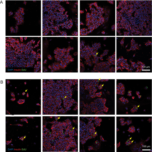 Figure 3. Beta cell nuclear doublets in pregnant serum-treated beta cells. Several representative images of beta cell monolayers stained for insulin, EdU incorporation and DAPI for nuclei following culture with 10% non-pregnant (A) or pregnant (B) human serum from pooled donors for one week. The images in panel (B) show evidence of primary human beta cell proliferation by the observation of EdU+ cells frequently occurring as doublets (yellow arrows), indicative of two neighboring daughter cells arising from a recent cell division event.