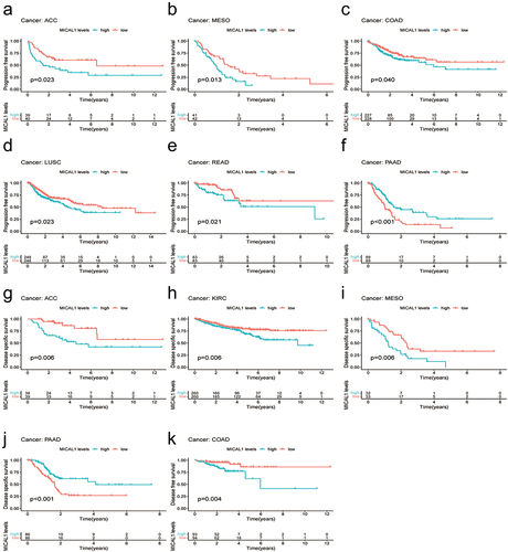 Figure 4. MICAL1 expression is associated with survival outcomes across multiple cancer types. (a-f) Kaplan-Meier curves of progression free survival based on MICAL1 expression levels in ACC, MESO, COAD, LUSC, READ and PAAD;(g-j) Kaplan-Meier curves of disease specific survival based on MICAL1 expression levels in ACC, KIRC, MESO, PAAD; (h) Kaplan-Meier curves of disease-free survival based on MICAL1 expression levels in COAD.