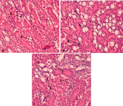 Figure 3. Histological features of kidney of Japanese quails supplemented with selenium nanoparticles (a) control group; (b) Se-NP treatment at the rate of 0.2 mg/kg; (c) Se-NP treatment at the rate of 0.4 mg/kg. g: glomerular; t: renal tubules; s: swelling; h: hemorrhage; s: sloughing of epithelial cells.