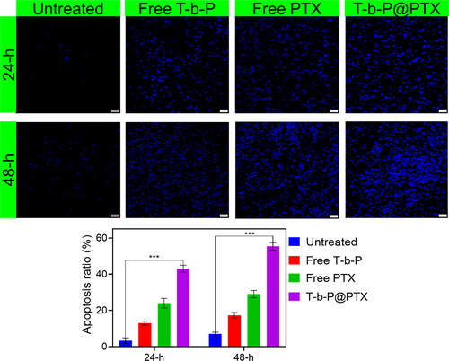 Figure 8. DAPI staining shows the induction of nuclear damage in the MCF-7 cells after being treated with T-b-P, PTX, and T-b-P@PTX in a time-dependent manner. Scale bar 40 µm. GraphPad Prism 8.0 was used to assess statistical significance: ***p < 0.001. Data are presented as mean ± standard deviation (SD).