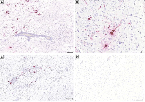 Figure 2. Detection of tick-borne encephalitis virus (TBEV) RNA in the brain of three Dalmatian puppies by in situ hybridization (ISH). Positive hybridization signals shown as red granular staining can be seen in the claustrum of puppy ‘S19-1708’ (a). Positive signals for TBEV RNA can be seen in the thalamus of puppy ‘S19-1722’ (B) and in the thalamus of puppy ‘S19-1723’ (C). No in situ detection of TBEV RNA in the brain of a healthy young dog serving as a negative control (D). Scale bars: 100 µm.