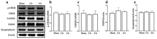 Figure 5. Effects of exposure to microwave on synapse related protein in hippocampus. (A) The results of WB, (B-E) The semi-quantitative of p-CREB, CREB, PSD95 and Synaptophysin, respectively.