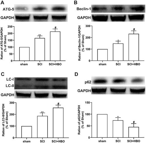 Figure 5. Induction of autophagy in spinal cord of the injury rats was enhanced following HBO treatment. (A–C) The increased expression of autophagy-related protein ATG-5, Beclin-1, LC-II following the injury was enhanced (n = 5 per/group). (D) The decreased expression of p62 was induced by SCI injury and boosted by HBO treatment (n = 5 per/group). *p<0.05,**p<0.01 compared with sham group, #p<0.05 compared with SCI group.