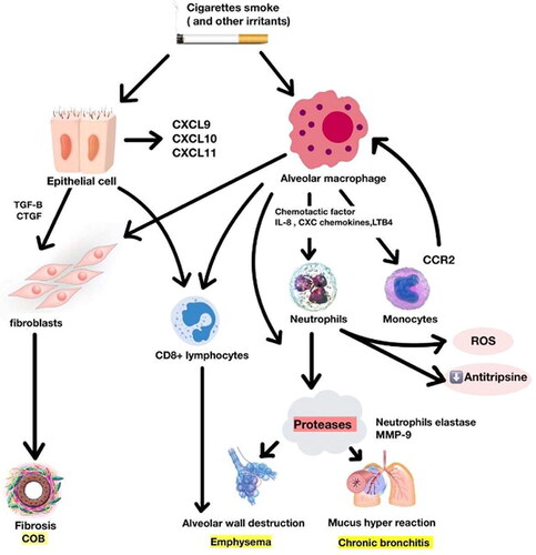 Figure 1. The inflammatory process in the pathogenesis of COPD.(MMP9:matrix metalloproteinase-9, COB: chronic obstructive bronchitis, ROS: reactive oxygen species, CTGF: connective tissue growth factor, TGF-β:transforming growth factor beta, CCR2: cc chemokine receptor2)