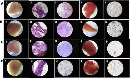 Figure 7. Low acute PRK-NP toxicity in zebrafish. (A) Tissues from untreated control animals: (1) heart (gross morphology), (2) myocardial fibres, (3) brain section, (4) liver (gross morphology), (5) liver histology. (B–D) Tissues from zebrafish receiving the compound at a concentration of (B) 3 µg/g body weight, (C) 30 µg/g body weight, or (D) 90 µg/g body weight.