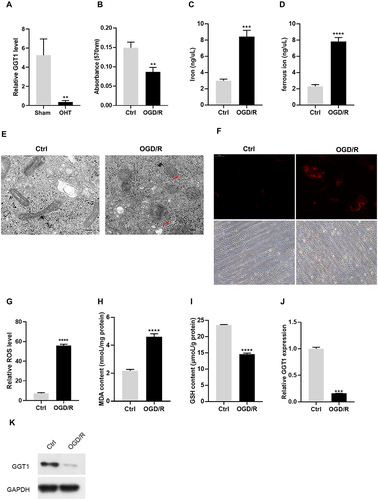 Figure 1 GGT1 expression in RGC-5 was decreased in OGD/R-induced RGC-5 (A). The difference of GGT1 gene expression between chronic ocular hypertension (OHT) mice and normal mice. (B) MTT assay showing the viability of RGC-5 cells with or without OGD/R induction. (C and D) The concentration of iron and ferric iron in RGC-5 cells after control or OGD/R treatment. (E) TEM images of RGC-5 cells after OGD/R treatment (the red arrow reflects the outer membrane of mitochondrion). (F) Ferrorange probe targeted the intracellular ferrous iron produced in RGC-5 cells. (G) The ROS level in RGC-5 cells in two groups (control, OGD/R) was detected. (H and I) The GSH and MDA levels in RGC-5 cells were detected. (J) qRT-PCR analysis examined the mRNA level of GGT1 in RGC-5. (K) Western blot analysis of GGT1 expression in RGC-5 cells after treated with OGD/R or untreated for 48 hours, full-length blots are presented in Supplementary Figure 1. **p < 0.01, ***p < 0.001, ****p < 0.0001.