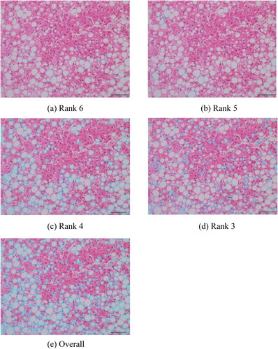 Figure 10. Lipid droplet detection image: each rank (a)–(d) and overall (e) [scale bar: 100 μm]. *A different version of the image in Figure 3(a) is displayed.