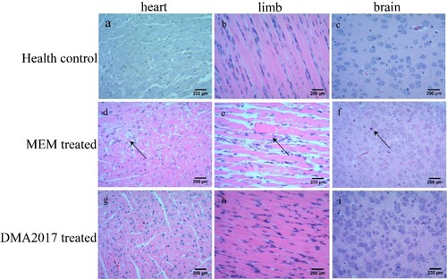 Figure 3. Histological examination results. In the group of health control and DMA2017 treated, no histological change was observed in the heart, brain and limb muscle. (d) In the MEM-treated group of mice, myocardial cell necrosis occurred in the heart. (e) MEM-treated mice exhibited severe muscle fiber necrosis in the limb muscle (arrow). (f) In the brain of mice, eosinophilic neuronal necrosis was observed occasionally. All the pathological changes are indicated by arrow. Representative images are shown at a magnification of 200×. Scale bar: 200 μm.