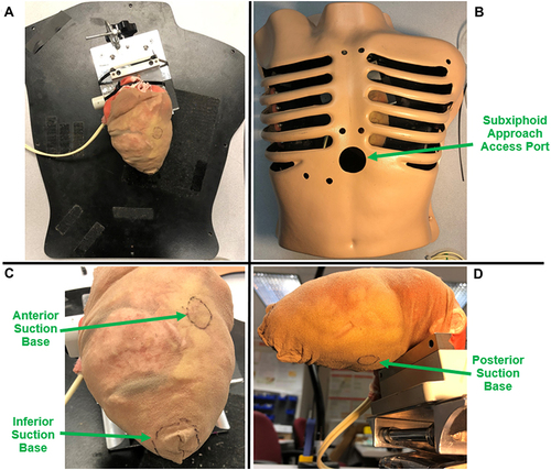 Figure 5 Testing model setup. (A) The rubber beating-heart was positioned anatomically and fixed in place. (B) Thorax with ribcage placed over the rubber heart. The subxiphoid approach access port was used for testing. (C and D) A nylon sock was placed snugly over the heart to replicate the pericardium. The target regions for the suction bases were labelled on the nylon sock with a marker.