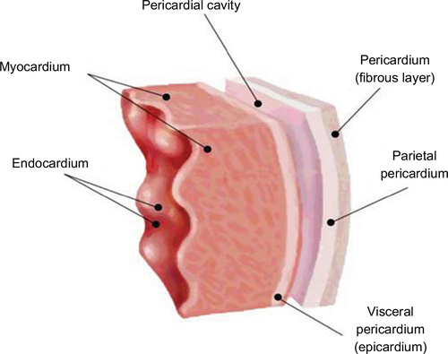 Figure 1 Cross-section of the pericardial and myocardial layers.