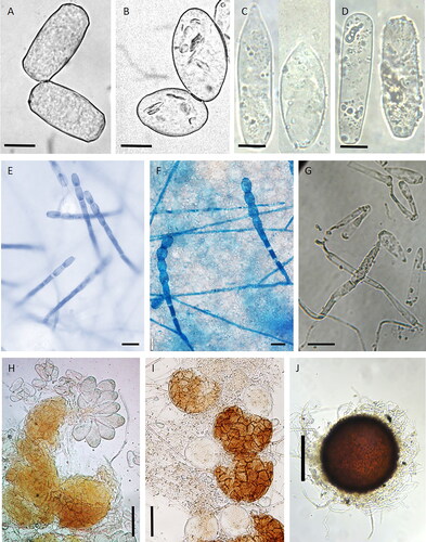 Figure 2. Microscopic characters of cucumber powdery mildews: (A) Golovinomyces orontii (conidia); (B) Podosphaera xanthii (conidia); (C) Leveillula taurica (primary conidia); (D) L. taurica (secondary conidia); (E) G. orontii (conidiophores); (F) P. xanthii (conidiophores); (G) L. taurica (conidiophores); (H) G. orontii (chasmothecium); (I) P. xanthii (chasmothecium); (J) L. taurica (chasmothecium). Photo credits: A. Lebeda (A,B), S. A. Khodaparast (C,D,G,J), L. Trecate (E,F), B. Sedláková (H,I). Bar represents: 10 µm (A–D), 20 µm (E–G), 50 µm (H,I) and 100 µm (J).