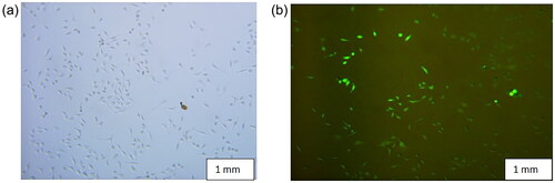 Figure 4. (a) Represents the control image of HeLa cell lines and (b) represents the magnetosome- FITC absorption process in HeLa cell lines recorded at 100 µg/mL Mag-FITC concentration.