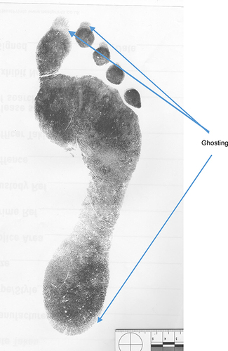 Figure 1 Example of ghosting at apices of toes and rear of the heel seen in dynamic footprints.