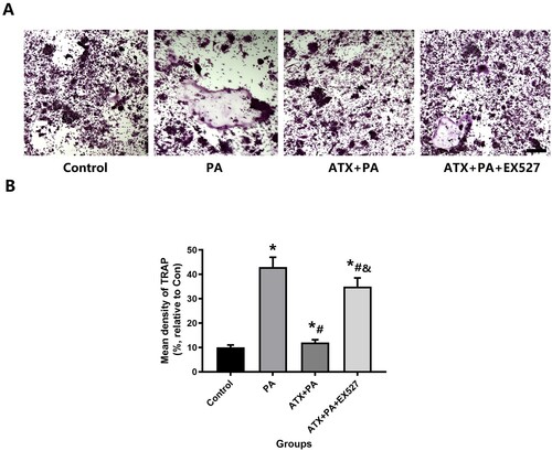 Figure 12. The increased osteoclast capacity in RAW264.7 cell treated by PA was disturbed by ATX treatment. (A) After adding ATX, the higher expression of TRAP decreased significantly by PA (scale bar = 50 µm); (B) for the quantitative analysis of TRAP staining positive areas. *vs Control group (P < 0.05); #vs PA group (P < 0.05); &vs ATX + PA group (P < 0.05).