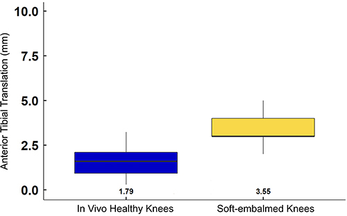 Figure 2 Anterior tibial translation of in vivo health knees versus soft-embalmed cadaver knees at 67N.