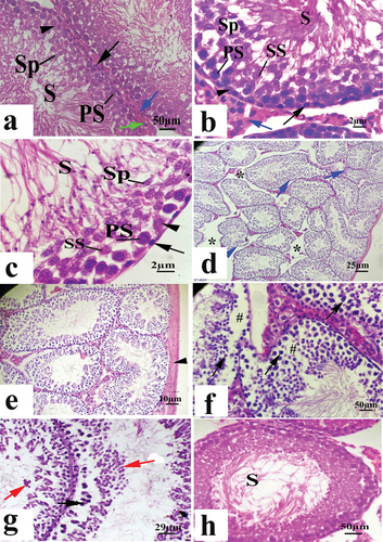 Figure 1. A photomicrograph of testicular tissue (a,b) control group, (c) saffron group showing: spermatogonia (black arrow), sertoli cell (arrowhead), primary spermatocyte (PS), secondary spermatocytes (SS), spermatids (sp), sperms (S), and interstitial tissue (blue arrow) containing leydig cell (green arrow); (d-g): khat group showing irregular seminiferous tubules (blue arrows) with variable shape and size, edematous lesions (*); thickening in the tunica albuginea (arrowhead), اثةdetachment of the spermatogenic layers (#), degenerated (black arrows) spermatogenic cells, exfoliated dead cells (red arrows); (h): khat and saffron group showing nearly normal seminiferous tubules filled with sperms (S) (H&E).