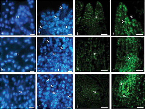 Figure 2. Stigma (a, d, g, j), style (b, e, h, k) and nucellar tissue (c, f, i, l) of male flower with DAPI (a–f) and TUNEL (g–l) assay. (a–c) Prior to PCD, chromatin is evenly distributed in the nuclei. (g–i) Prior to PCD, TUNEL is negative. (d–f) Condensed chromatin (arrow) in nuclei in advanced stage of PCD. (j–l) TUNEL is positive (arrow) in advanced stage of PCD. sg, stigma; st, style; nu, nucellus. Scale 10 µm (a–f) and 50 µm (g–l).