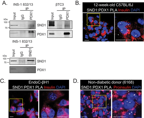 Figure 1. PDX1 and SND1 interact in rodent and human β cell lines and primary β cells. (a) co-immunoprecipitation of PDX1 or SND1, followed by immunoblotting for PDX1 and SND1 in INS-1 832/13 and βTC3 nuclear extracts. (b-d) proximity ligation assays (PLAs) using antibodies for SND1 and PDX1 were performed on (b) 12-week-old C57BL/6J, (c) human EndoC-βH1 β cells, and (d) 51-year-old non-diabetic male donor tissues acquired from nPOD (donor # 6168). The images on the right in b-d are magnified regions outlined in the yellow box. The white, fluorescent foci from the PLA represent individual PDX1:SND1 interactions. (scale bars = 10 μm).