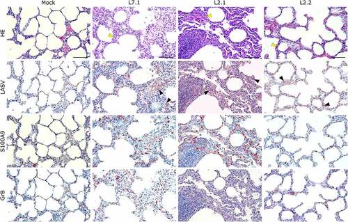 Figure 5. Comparative histopathology of the lung after challenge with L7 or L2 LASV strains. HE: hematoxylin-eosin coloration. Yellow arrowheads show severe (L7.1 and L2.1) or mild (L2.2) septal thickening. LASV: immunostaining of LASV glycoprotein-2c. Black arrowheads show infected cells. S100A9: immunostaining of neutrophils. GrB: immunostaining of cytotoxic cells. Scale bar: 100 µm.