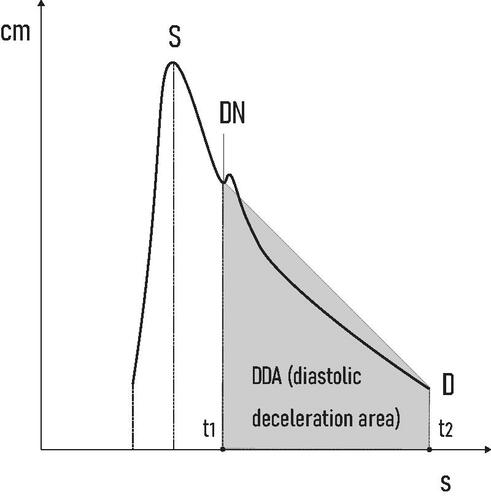 Figure 4. DDA is defined by DN: dicrotic notch, D: end diastolic velocity and Δt: (t2–t1).