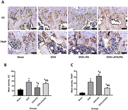 Figure 4. Systemic administration of ATX modulates osteoblast and osteoclast activity in OVX rats treated with PA. (A) Representative images were analyzed by immunohistochemistry for OC and TRAP. (B) Quantitative analysis of OC and TRAP (magnification, ×63). *vs Sham group (P < 0.05); #vs OVX group (P < 0.05); &vs OVX + PA group (P < 0.05).