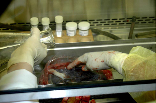 Figure 1 Under a lamellar flow hood, the placenta washed with sterile saline.