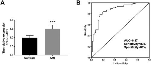 Figure 1. The expression and clinical diagnostic value of BRE-AS1 in AMI. (A) The serum expression level of BRE-AS1 in patients with AMI (data are presented as mean and standard deviation, independent samples t-test was used). (B) ROC curve analysis. The area under the curve (AUC) of ROC curve is 0.868, the sensitivity is 82.70% and the specificity is 81.40%. ***p < .001 vs. control group. BRE-AS1: brain and reproductive organ-expressed protein (BRE) antisense RNA 1; AMI: acute myocardial infarction; ROC: receiver operator characteristic; AUC: area under the curve.