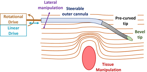 Figure 1 Summary of techniques applied to needle steering, emphasizing the asymmetric (eg, bevel) tip, pre-curved needle segments, steerable outer cannula, independent tissue manipulation, lateral manipulation, and positioning based linear or rotational motion, as defined in relation to the needle central axis. Data from Cowan et al.10