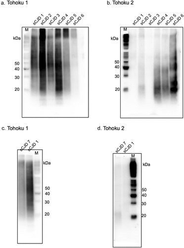 Figure 4. Western blotting analyses of the formalin-fixed paraffin-embedded (FFPE) samples with the Tohoku 1 (specific for type 1 scrapie prion protein [PrPSc]) and Tohoku 2 (specific for type 2 PrPSc) anti-proteinase K-resistant PrP (PrPres) antibodies. (a, b) Sporadic Creutzfeldt–Jakob disease (sCJD) 1 and 3 show bands of PrPres at 21–30 kDa and high molecular smears with Tohoku 1, whereas Tohoku 2 shows no signal. In sCJD 2, 4, and 5, PrPres signals are observed both with Tohoku 1 and 2. sCJD 6 shows a weak signal with Tohoku 1 but a strong signal with Tohoku 2. (c, d) sCJD 7 shows a smear band with Tohoku 1 and a weak smear band at approximately 20 kDa with Tohoku 2.