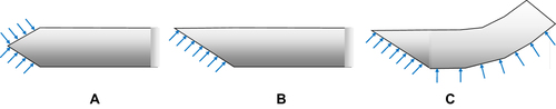 Figure 3 Needle tip shapes featuring (A) a symmetric and cone-shaped tip, (B) an asymmetric beveled tip. (C) Combination of bevel tip and pre-bent needle shape. Data from Cowan et al.10