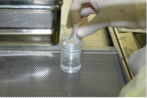 Figure 9 The amniotic membrane is stored in a sterile vial containing 10% DMSO medium, and preserved at −80°C.