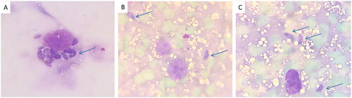 Figure 6. T. gondii tachyzoites in the liver impression smears (blue arrows) of (A) group I, (B) group II, and (C) group III.