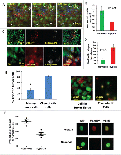 Figure 5. Hypoxic tumor cells are enriched in the invasive and chemotactic tumor cell population in vivo. (A) Multiphoton microscopy images of GFP-MDA-MB-231-5HREODD-mCherry xenograft tumor cells at 0, 11 and 28 minutes. White arrows point to GFP-only normoxic cells. Red arrow points to a motile mCherry positive hypoxic cell. Each moving cell outline was traced. The green outlined cells are normoxic cells and the red outlined cell is a hypoxic cell. Green=GFP normoxic, Red=mCherry hypoxic, Blue=Second Harmonic Generation (SHG) from collagen. (B) Quantification of average cell velocity in vivo migration for hypoxic and normoxic cells. Fields of view containing hypoxic cells were analyzed for motion of either green normoxic and/or red hypoxic cells, n=28. P=0.02 (Student's t-test), error bars: mean±s.e.m. (C) Representative images of collagen ¾antibody staining on GFP MDA-MB-231 hypoxia reporter derived tumor tissue frozen sections showing overlap of collagen degradation with hypoxic tumor cells. The lower panel images are at higher magnification to have a better view of the collagen¾ antibody staining around single cells. Red=mCherry hypoxic, green=GFP normoxic, gray=collagen¾, blue=nuclei. (D) Quantification of the percent of cells with collagen degradation within the normoxic or hypoxic tumor cell populations. Each bar is the percentage of the respective cell type. The green bar is normalized to the number of total green cells while the red bar is normalized to the total number of hypoxic cells. Fields of view containing collagen degradation were analyzed. P value is by Student's t-test, error bars: mean±s.e.m., n=5. (E) Percentage of hypoxic cells in the population that migrated to HuEGF gradient (chemotactic cells) vs the percentage of hypoxic cells in primary tumor tissue where the needle was placed. Representative images are tumor cells in primary tumor tissue and chemotactic tumor cells collected using the in vivo invasion assay with 25 nM huEGF. Red=mCherry hypoxic, green=GFP normoxic. Error bar: SEM. * p<0.05 (Student's t-test), n=3 mice. (F) Analysis of circulating tumor cells. CTCs were imaged for mCherry and GFP signals. mCherry and GFP pixel intensity was normalized to the highest signal in each channel respectively among the CTCs. The ratio of the normalized mCherry to GFP signals in individual cells was calculated. Ratio of normalized mCherry to GFP below 0.5 = normoxia, above 0.5 = hypoxia. The percentage of hypoxic and normoxic cells were plotted. 4 mice were used. The representative images for hypoxic and normoxic cells are shown on the right.