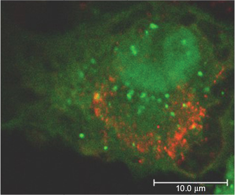 Figure 4 Confocal image of Vero cell transfected with the autophagosome marker GFP-LC3 plasmid and infected with USUV (red).