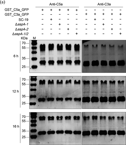 Figure 4. S. suis strains at stationary phase (4 × 106 CFU) were incubated with GST_C3a_GFP (0.5 μg) or GST_C5a_GFP (0.5 μg) in TSB for 6, 12 and 16 hours. Protease inhibitor cocktail in GST_C3a_GFP or GST_C5a_GFP without S. suis strains was used as a negative control. Monoclonal antibodies specific for C3 or C5 were applied for C3a and C5a immunodetection, respectively.